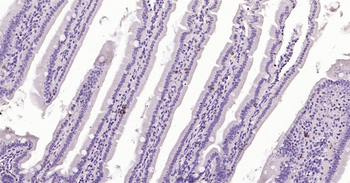 CHGA Ready-To-Use IHC Kit