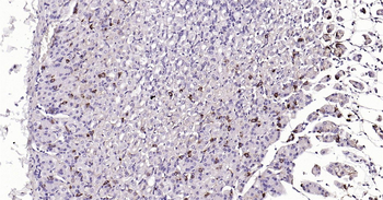 CHGA Ready-To-Use IHC Kit