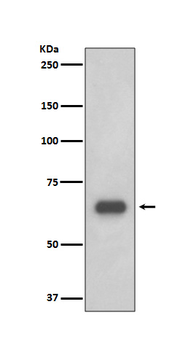 RPS6KB1 Recombinant Rabbit Monoclonal Antibody