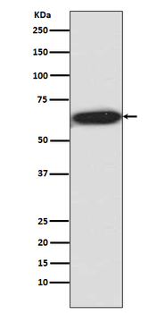 Phospho-RPS6KB1 (Thr421/Ser424) Recombinant Rabbit Monoclonal Antibody