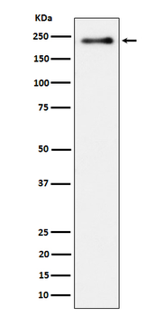 Phospho-LRP6 (Ser1490) Recombinant Rabbit Monoclonal Antibody