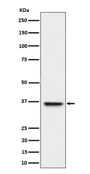 ULBP1 Recombinant Rabbit Monoclonal Antibody