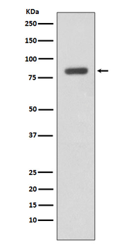 IKK beta Recombinant Rabbit Monoclonal Antibody