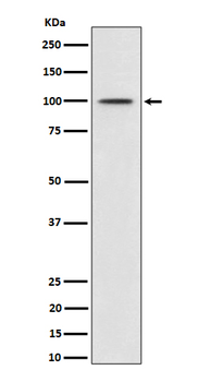 Phospho-MDM2 (Ser166) Recombinant Rabbit Monoclonal Antibody