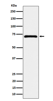 EPHX2 Recombinant Rabbit Monoclonal Antibody