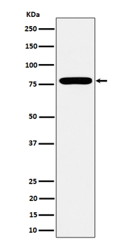 GFPT1 Recombinant Rabbit Monoclonal Antibody