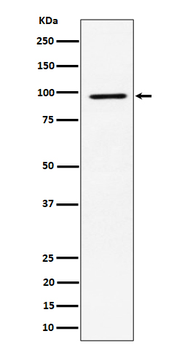 RPS6KA3 Recombinant Rabbit Monoclonal Antibody