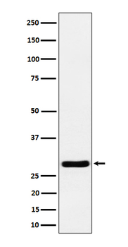 Calcipressin 1/DSCR 1 Recombinant Rabbit Monoclonal Antibody