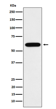 TUB 1 Recombinant Rabbit Monoclonal Antibody