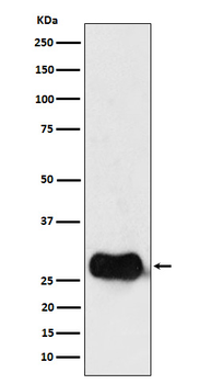 HLA DMB Recombinant Rabbit Monoclonal Antibody
