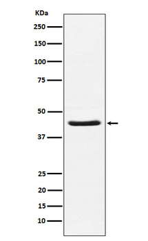 HSD3B1 Recombinant Rabbit Monoclonal Antibody