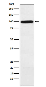 Factor B Recombinant Rabbit Monoclonal Antibody