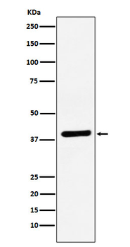 VEGF-D Recombinant Rabbit Monoclonal Antibody