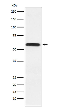 LGI1 Recombinant Rabbit Monoclonal Antibody