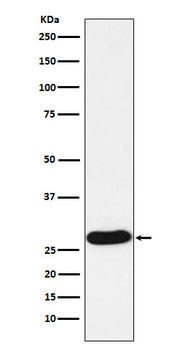 PR3 Recombinant Rabbit Monoclonal Antibody