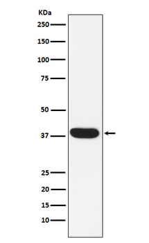 MYF5 Recombinant Rabbit Monoclonal Antibody