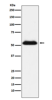 TMPRSS2 Recombinant Rabbit Monoclonal Antibody