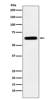 DPYSL5 Recombinant Rabbit Monoclonal Antibody