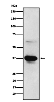 DFFA Recombinant Rabbit Monoclonal Antibody