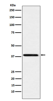 SAE1 Recombinant Rabbit Monoclonal Antibody