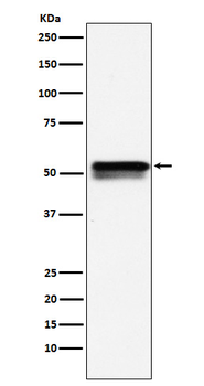 EGR2 Recombinant Rabbit Monoclonal Antibody