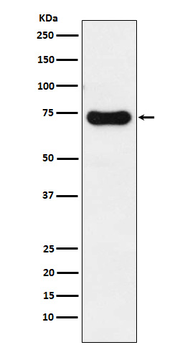 IRAK2 Recombinant Rabbit Monoclonal Antibody