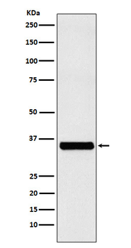 EXOSC7 Recombinant Rabbit Monoclonal Antibody