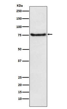 BDKRB2 Recombinant Rabbit Monoclonal Antibody