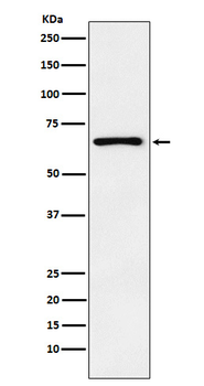PTH1R Recombinant Rabbit Monoclonal Antibody