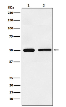 Hepatitis A virus cellular receptor 1 Recombinant Rabbit Monoclonal Antibody