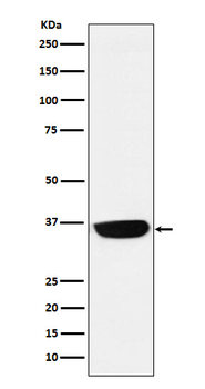 PHOX2B Recombinant Rabbit mAb