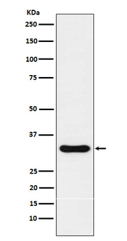 Nkx3.1 Recombinant Rabbit Monoclonal Antibody
