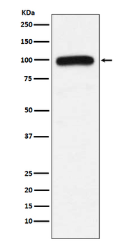 UBE3A Recombinant Rabbit Monoclonal Antibody