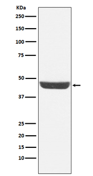 NDRG1 Recombinant Rabbit Monoclonal Antibody