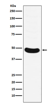 MNX1/HLXB9 Recombinant Rabbit Monoclonal Antibody