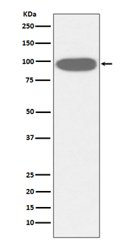 GRP94 Recombinant Rabbit Monoclonal Antibody