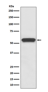 Aromatase Recombinant Rabbit Monoclonal Antibody