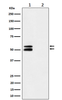 Phospho-CaMK2 alpha (T286) Recombinant Rabbit Monoclonal Antibody
