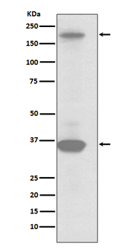 MST1R Recombinant Rabbit Monoclonal Antibody