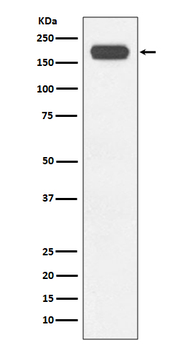 SMARCA4 Recombinant Rabbit Monoclonal Antibody