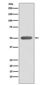 ERR-alpha Recombinant Rabbit Monoclonal Antibody