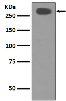 Acetyl CoA carboxylase Recombinant Rabbit Monoclonal Antibody