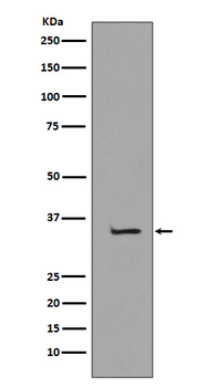 TBP Recombinant Rabbit Monoclonal Antibody
