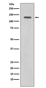 RAD21 Recombinant Rabbit Monoclonal Antibody