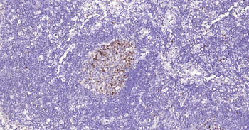 TOP2A Recombinant Rabbit Monoclonal Antibody