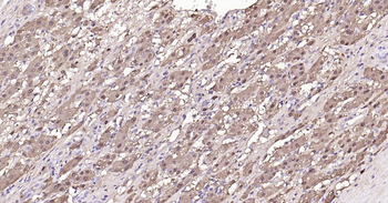 Arginase 1 Mouse Monoclonal Antibody
