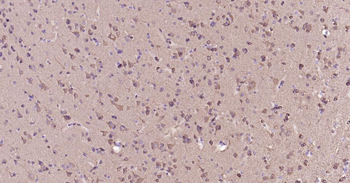 STMN1 Mouse Monoclonal Antibody