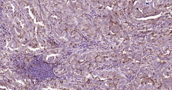 STMN1 Mouse Monoclonal Antibody