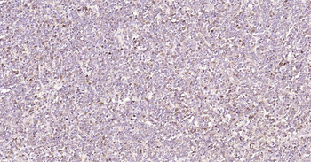 STMN1 Mouse Monoclonal Antibody