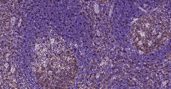 STMN1 Mouse Monoclonal Antibody